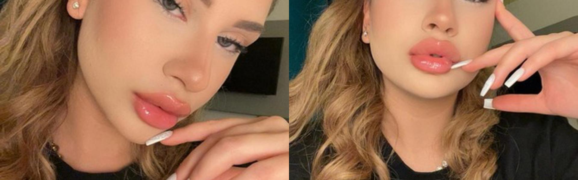 Ảnh tiêu đề hồ sơ