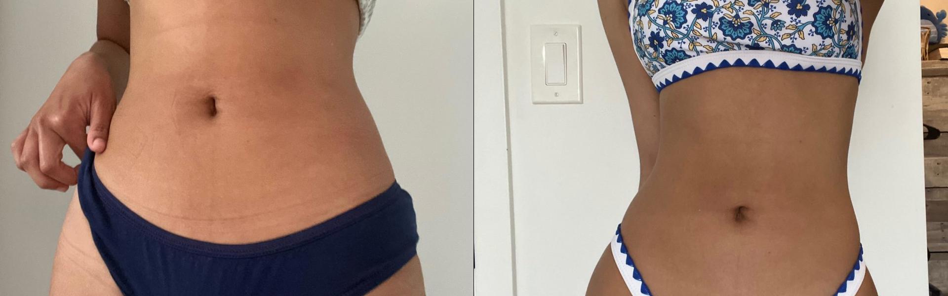 Зображення заголовка профілю