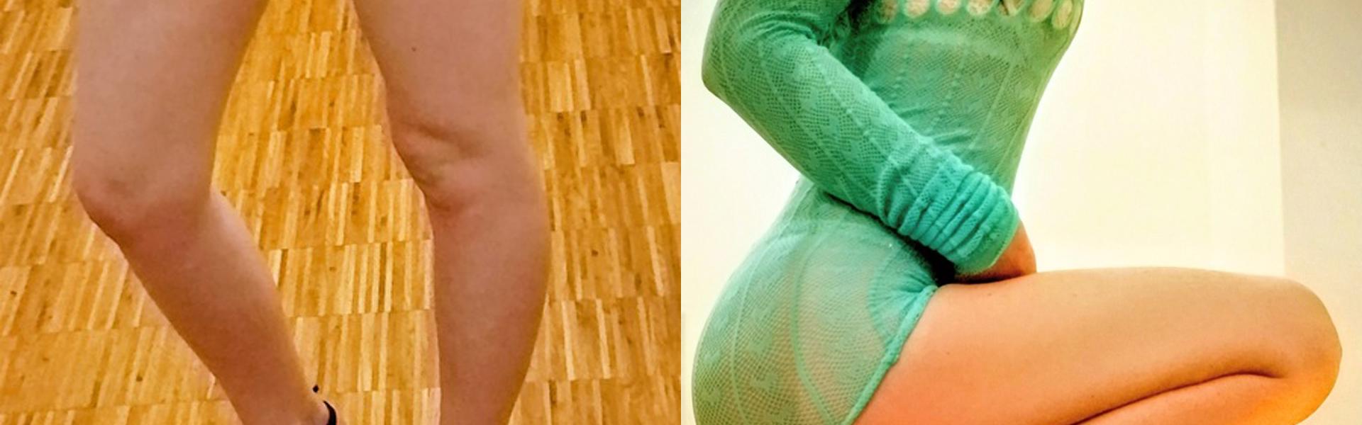 Ảnh tiêu đề hồ sơ