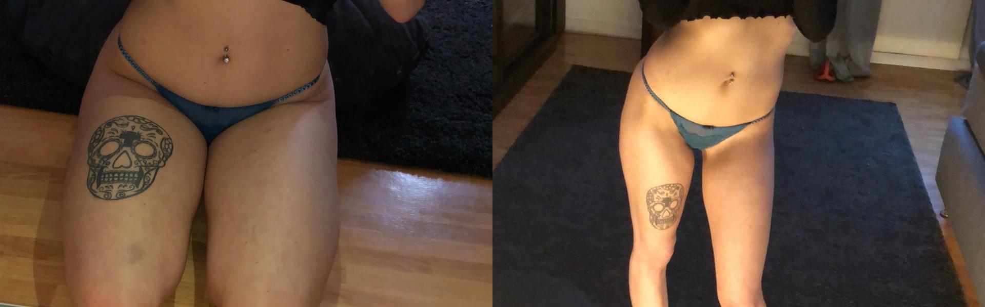 ภาพส่วนหัวโปรไฟล์