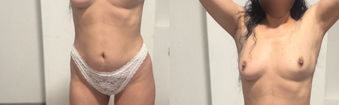 Profil-headerbillede