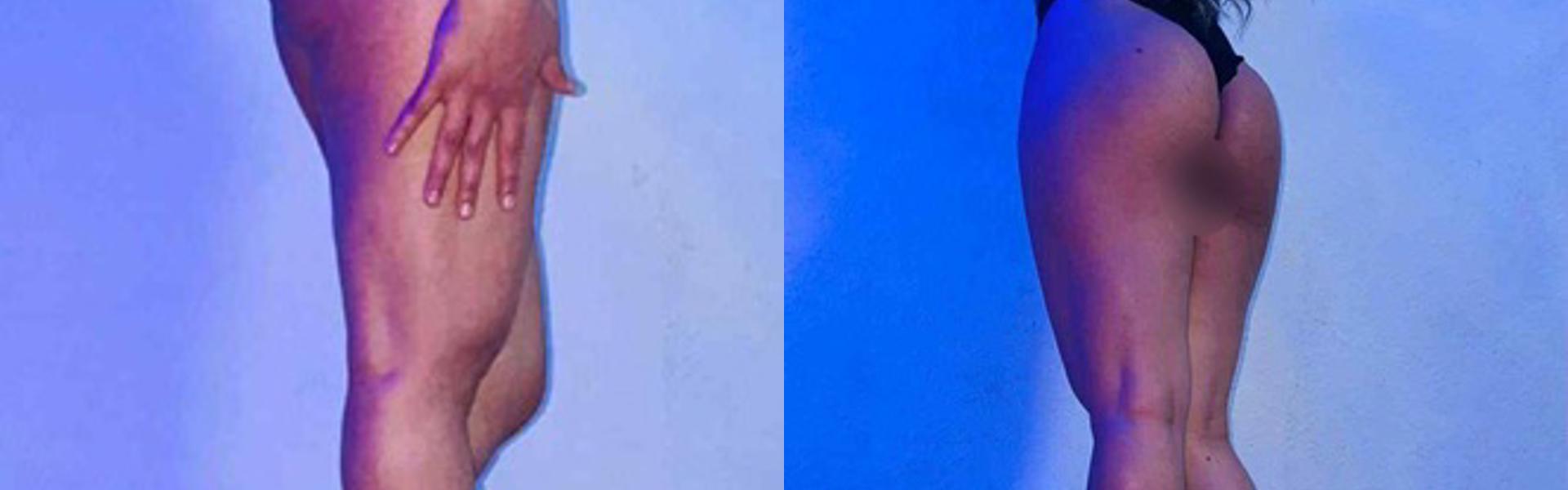 Profil-headerbillede